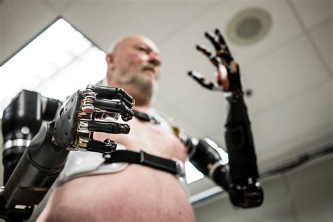 Bionic Human Brabet