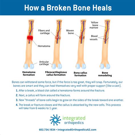 Break Bones Betway