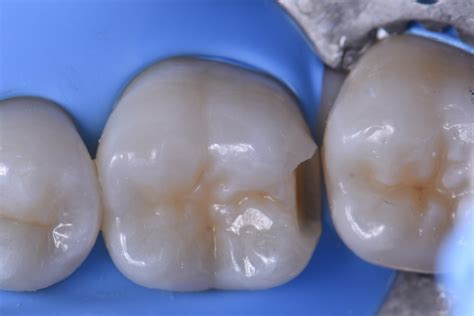 Dental Slot