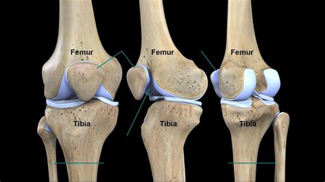 Tibia Fenda Na Strzaly